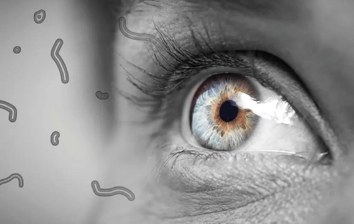 Co jsou ty „poletující mušky“ před očima?